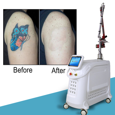 4 golflengten Nd YAG Q Switch Laser Machine Tatoeage verwijdering
