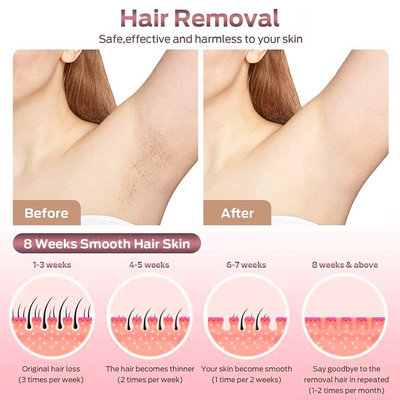 2000W Diode Laser Hair Removal Device 4 golflengten 808nm 755nm 940nm 1064nm