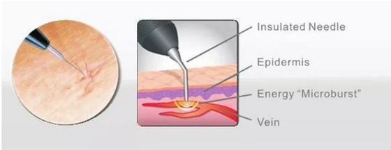Schoonheidssalon 980nm diode laser machine voor pijnverlichting / vasculaire behandeling
