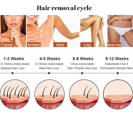 Trio 3 golflengten Diodo Laser 755/808/1064nm voor Alexandriet Ice Laser Hair Removal