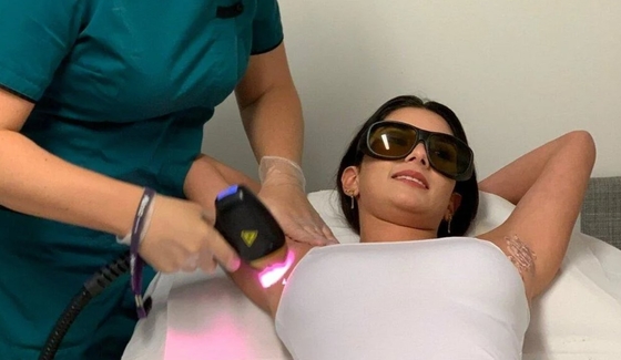 808nm Diode Laser Hair Removal Machine TUV ISO CE-certificering voor het verwijderen van poriën