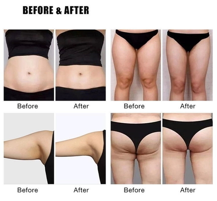Gewichtsverlies EMS Slim Machine 4000W Elektromagnetische Body Slimming EMS Sculpting Machine