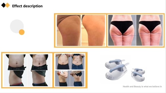 ABS EMS Body Sculpting Machine Commerciële elektrische EMS spierstimulator