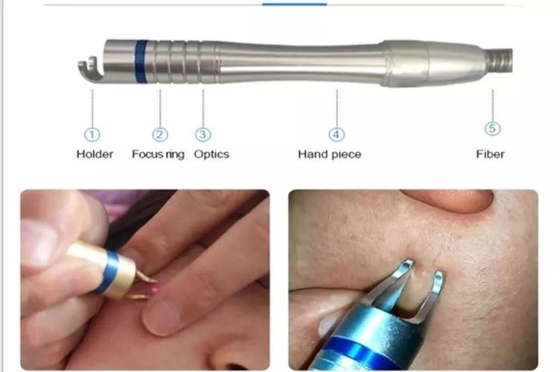 15W 30W laser vasculaire verwijdering machine voor de behandeling van de teennagel / Hot Laser huidverjonging