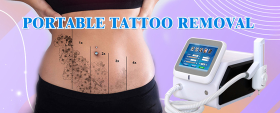 Medische Nd YAG haarverwijderingsmachine 1064nm 532nm Laser tatoeage verwijdering apparatuur