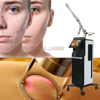 Professionele Fractionele Laser CO2-machine voor huidverlichting / -verstrekking