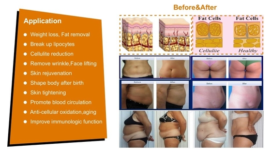 Commerciële Cavitatie RF Vacuum Slimming Machine 7 in 1 Voor Schoonheidscentrum