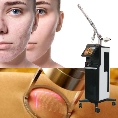 Fractionele CO2 laser huid vernieuwen schoonheid apparatuur Stretch Marks Removal Machine