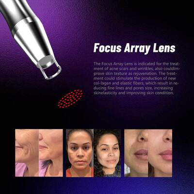 3000W 350PS Picosecond Pico Way Laser Pigment Verwijdering Nd Yag Laser Picosecond Tatoo Verwijdering Laser Machine EU Plug